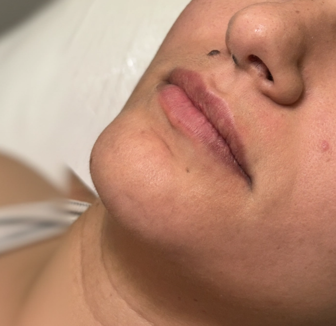 Foto Antes do Tratamento 4