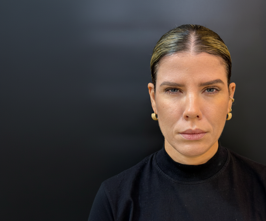 Foto Depois do Tratamento 3