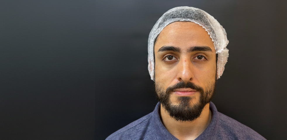 Foto Depois do Tratamento